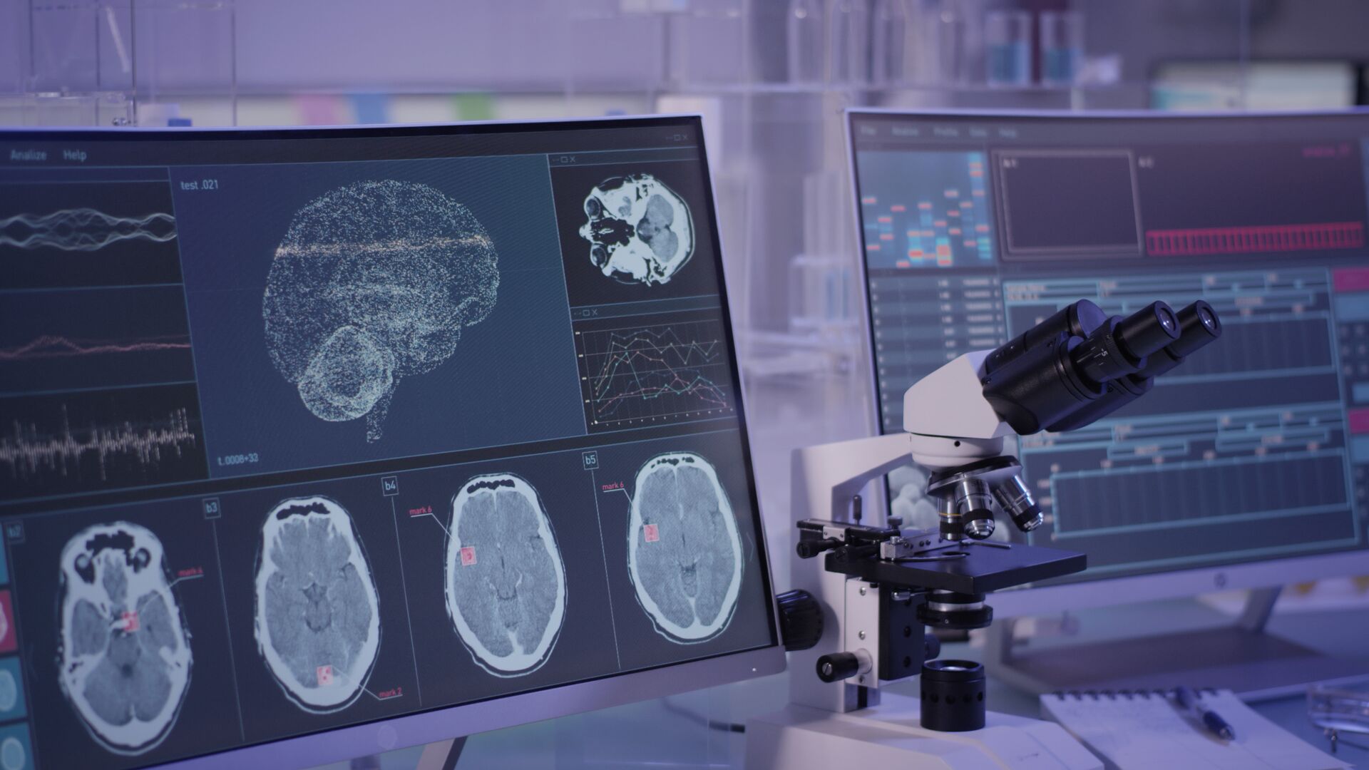 A laboratory desk with a microscope and a screen featuring several scans of a brain