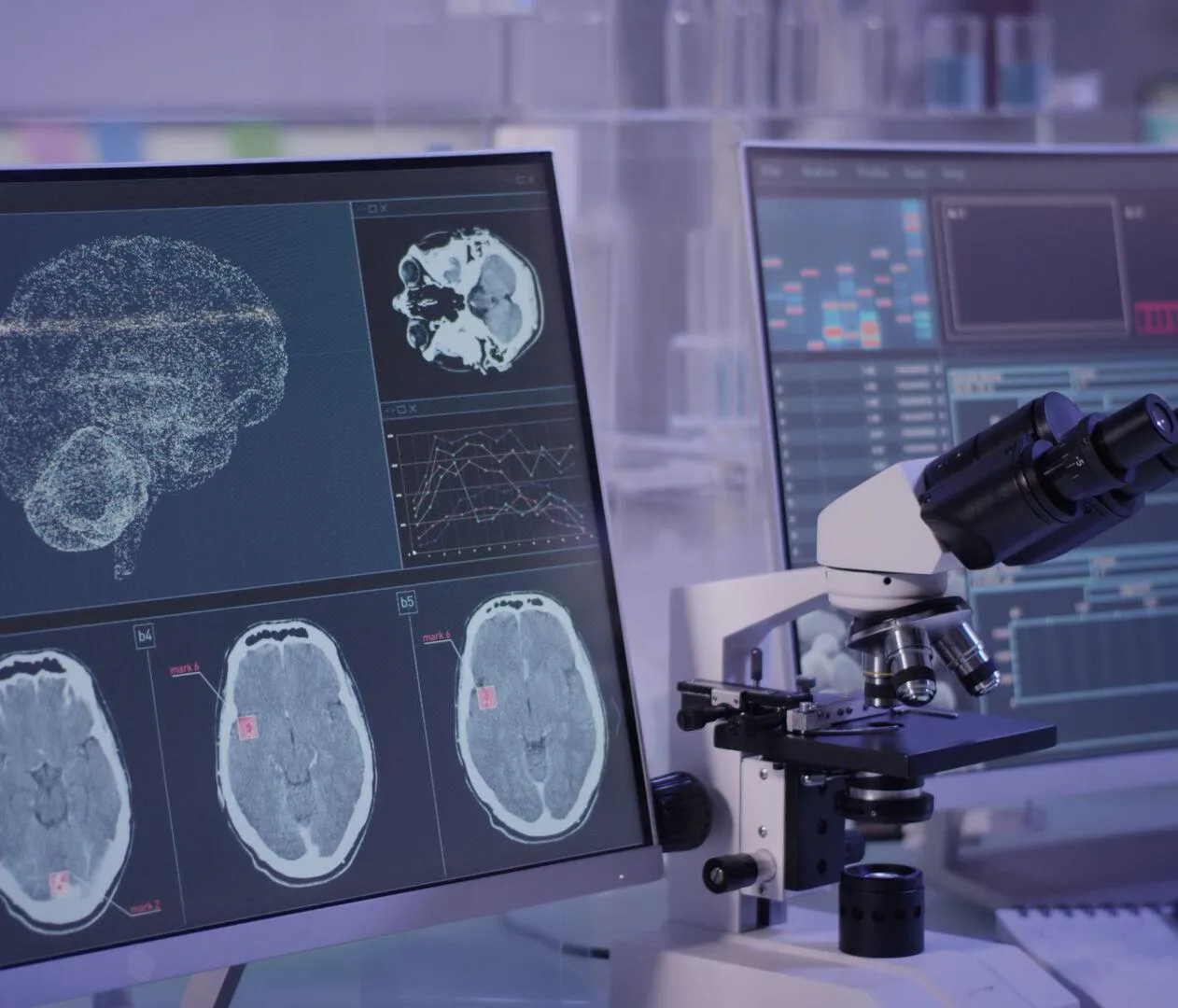 A laboratory desk with a microscope and a screen featuring several scans of a brain