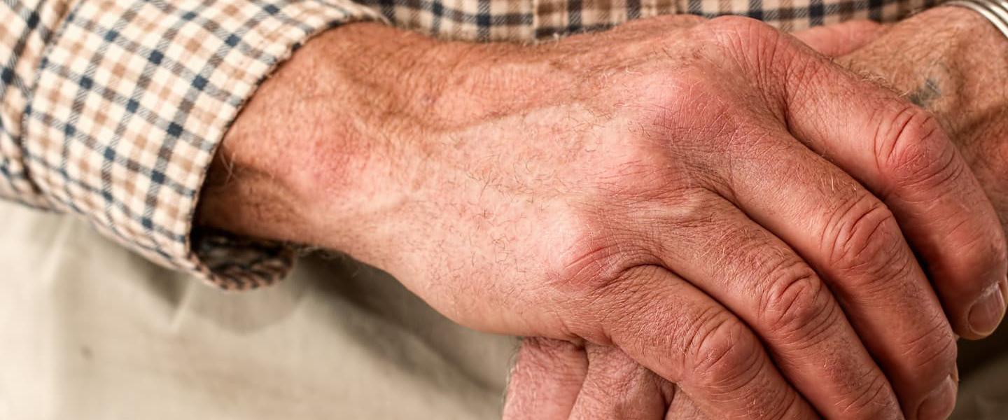 Aging
